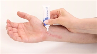 موثرترین راه برای رفع جای زخم